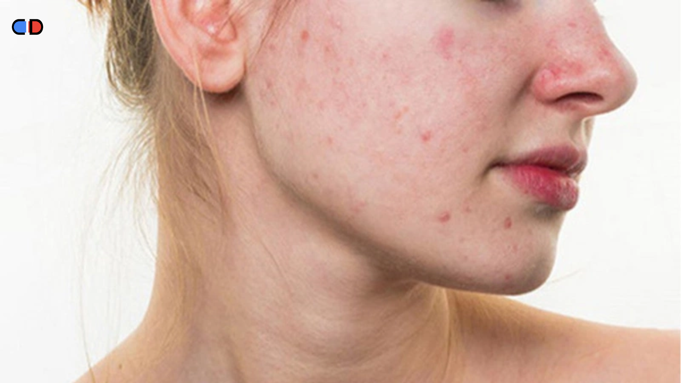 giải độc cơ thể đúng cách